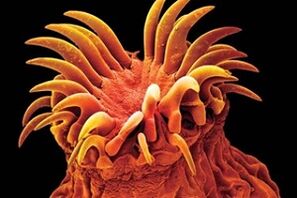 ប៉ារ៉ាស៊ីត Trematode នៅក្នុងមនុស្ស