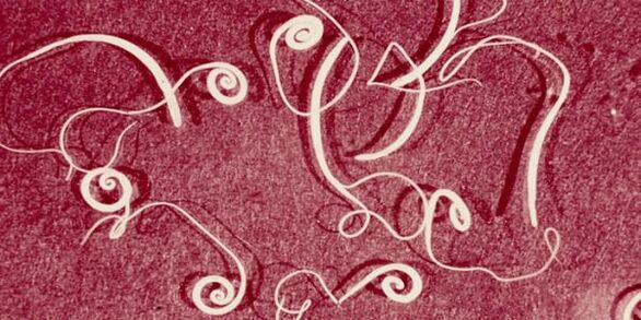 រូបថតប៉ារ៉ាស៊ីតរបស់មនុស្ស