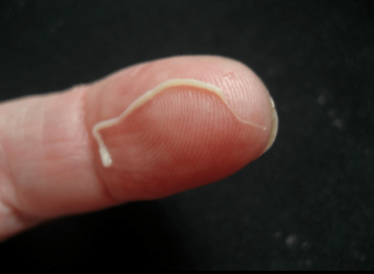 ប៉ារ៉ាស៊ីតរាងមូលពីរាងកាយមនុស្ស